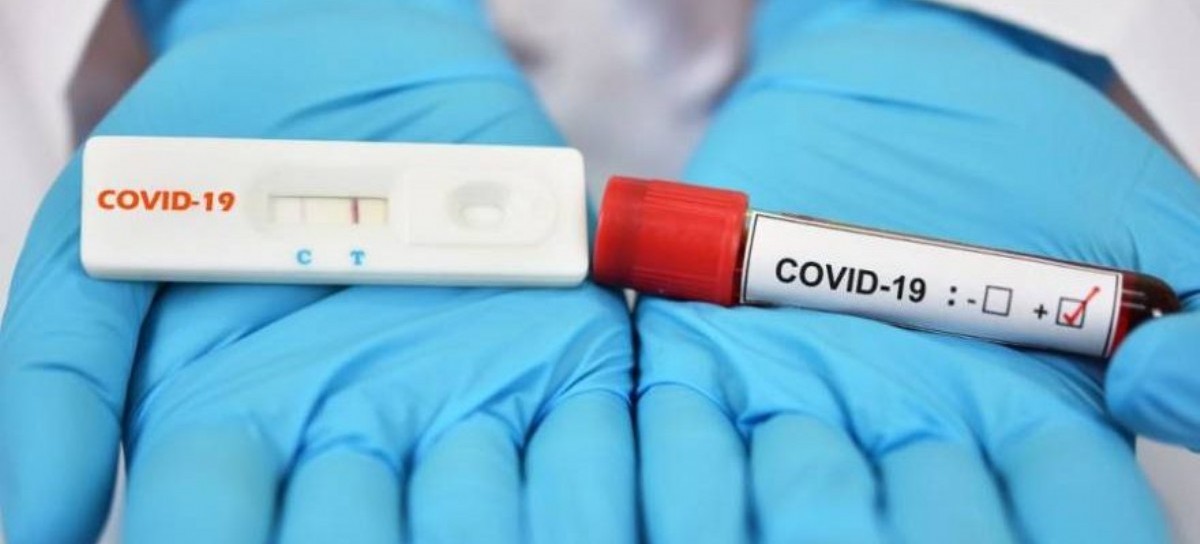 Coronavirus: el Gobierno nacional confirmó 117 muertes y 5.344 nuevos contagios en las últimas 24 hs