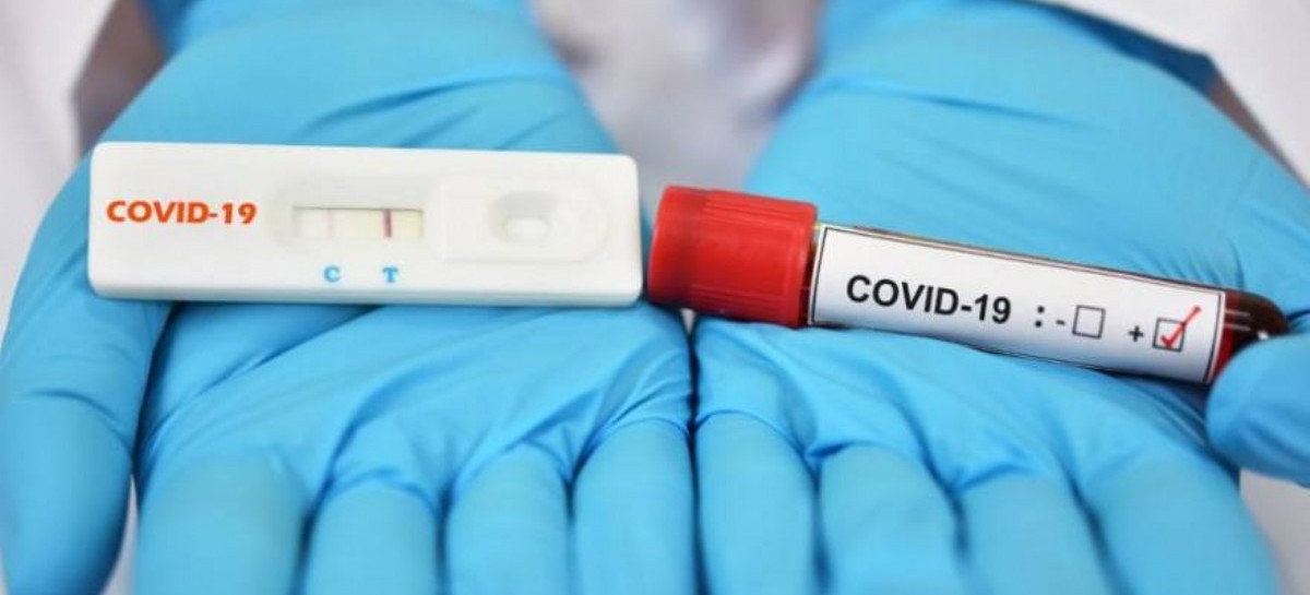 Coronavirus: el Gobierno nacional confirmó 206 muertes y 8.841 nuevos contagios en las últimas 24 hs
