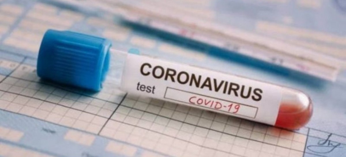 REPORTE DIARIO VESPERTINO NRO 248 | SITUACIÓN DE COVID-19 EN ARGENTINA: 3.624 nuevos casos