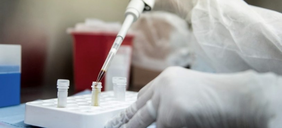 Coronavirus: el Gobierno nacional confirmó 429 muertes y 8.782 nuevos contagios en las últimas 24 hs