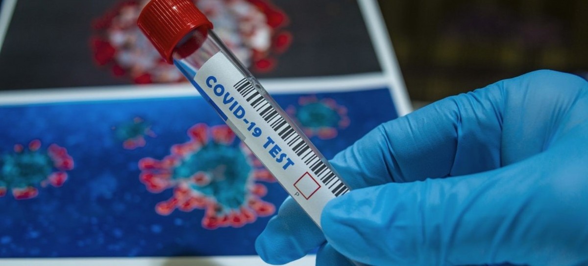 Coronavirus: el Gobierno nacional confirmó 197 muertes y 11.129 nuevos contagios