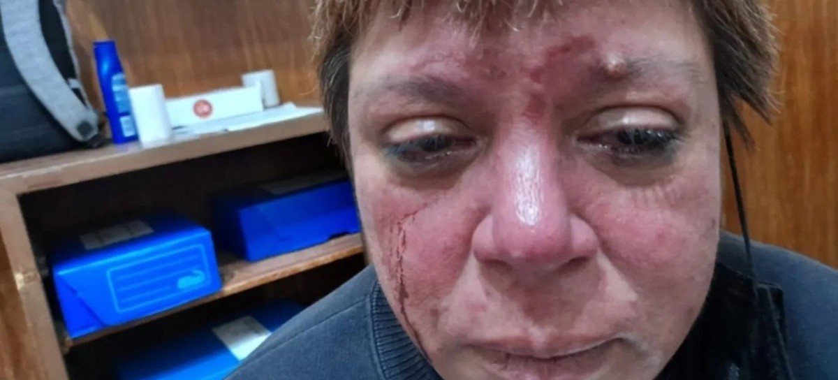 Juicio oral a la dueña del bar de 4 y 53 por brutal agresión a una inspectora