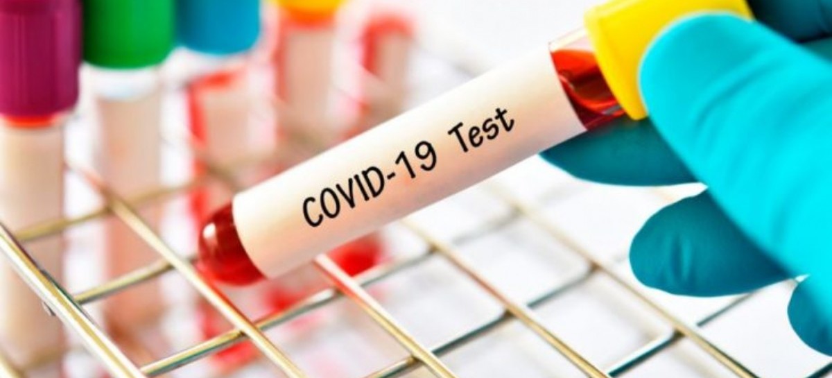 Coronavirus: el Gobierno nacional confirmó 245 muertes y 12026 nuevos contagios en las últimas 24 hs