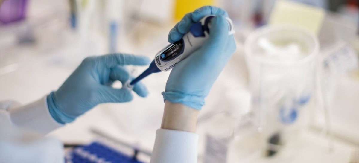 03-12-2020 // Coronavirus: el Gobierno nacional confirmó 149 muertes y 7.629 nuevos contagios