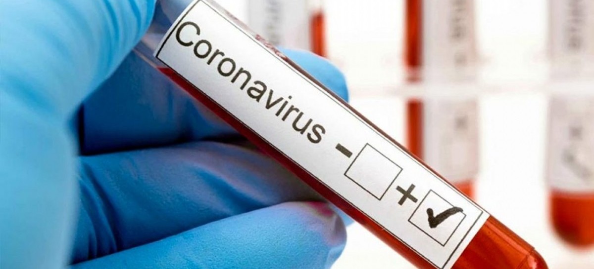 Coronavirus: el Gobierno nacional confirmó 114 muertes y 6.127 nuevos contagios en las últimas 24 hs