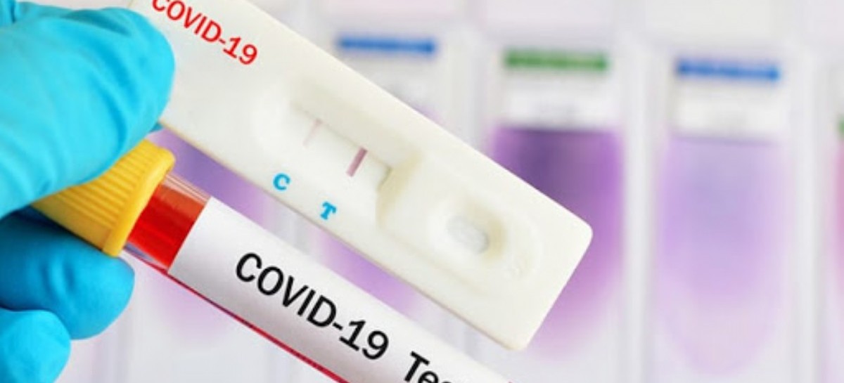 Coronavirus: el Gobierno nacional confirmó 223 muertes y 7.668 nuevos contagios