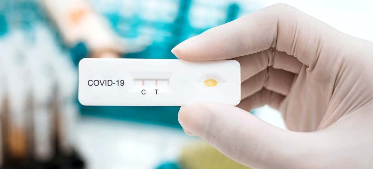 Prohíben a las farmacias bonaerenses vender las pruebas rápidas para detectar COVID-19