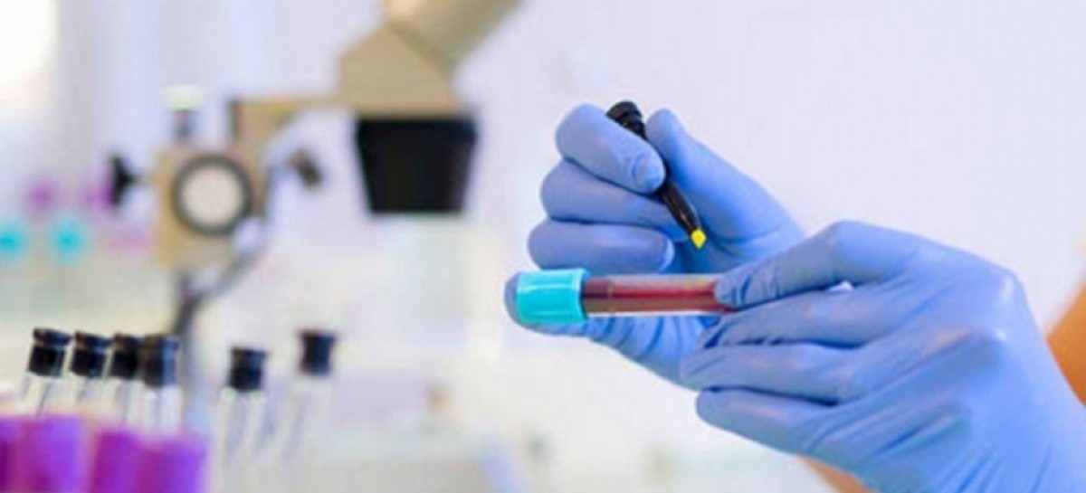 Coronavirus: el Gobierno nacional confirmó 470 muertes y 12027 nuevos contagios en las últimas 24 hs