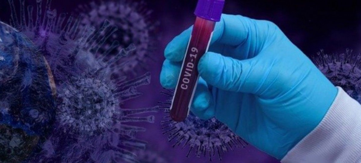 Coronavirus: el Gobierno nacional confirmó 262 muertes y 10684 nuevos contagios en las últimas 24 hs
