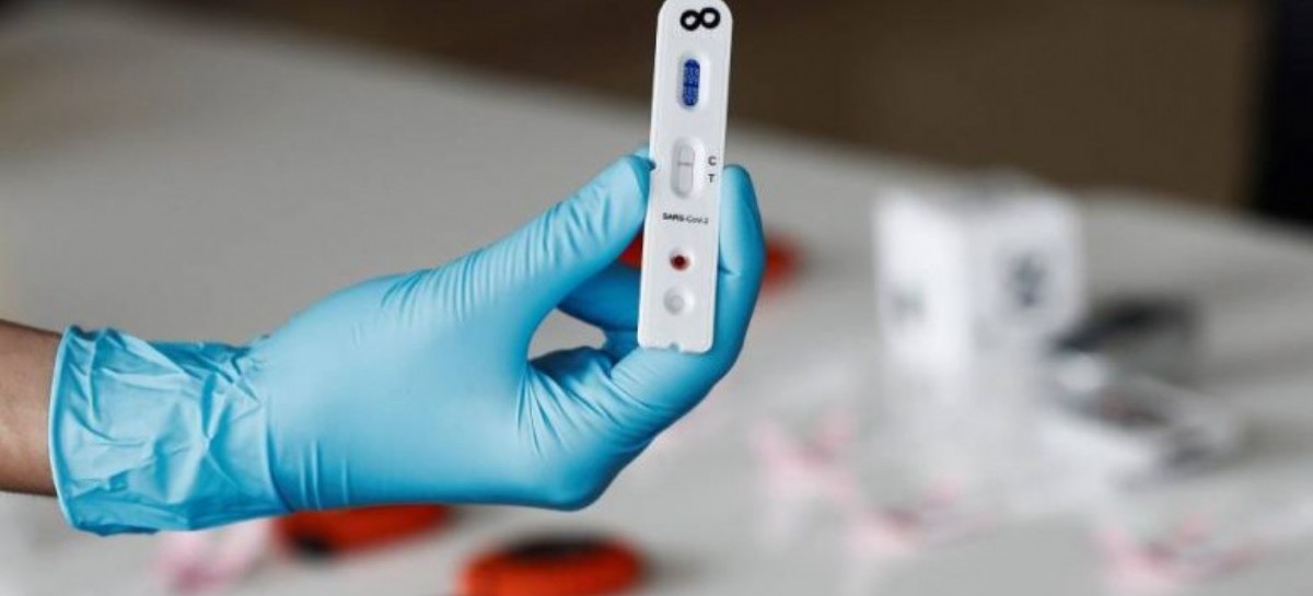 04-11-2020 // Coronavirus: el Gobierno nacional confirmó 469 muertes y 10.652 nuevos contagios