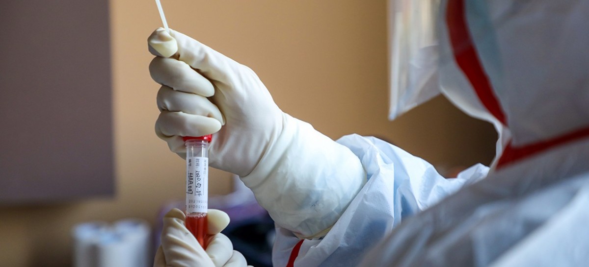 Coronavirus: el Gobierno nacional confirmó 211 muertes y 10104 nuevos contagios en las últimas 24 hs