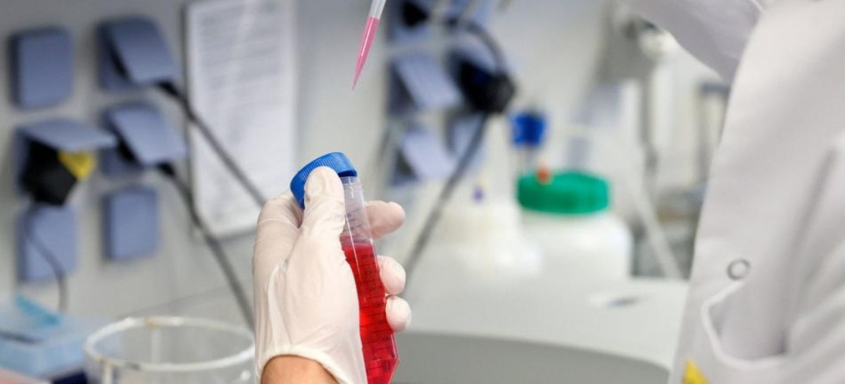 Coronavirus: el Gobierno nacional confirmó 111 muertes y 4.557 nuevos contagios en las últimas 24 hs