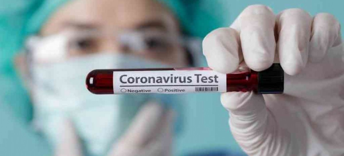 Coronavirus: el Gobierno nacional confirmó 241 muertes y 7.043 nuevos contagios en las últimas 24 hs