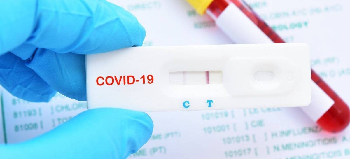 Coronavirus: el Gobierno nacional confirmó 105 muertes y 5.493 nuevos contagios en las últimas 24 hs