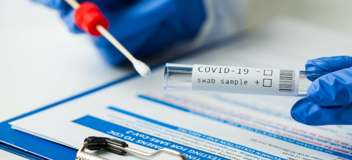 Coronavirus: el Gobierno nacional confirmó 452 muertes y 11.242 nuevos contagios