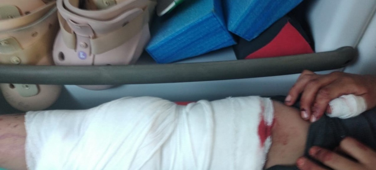 Tres menores robaron en una farmacia céntrica de La Plata y uno de ellos terminó herido e internado