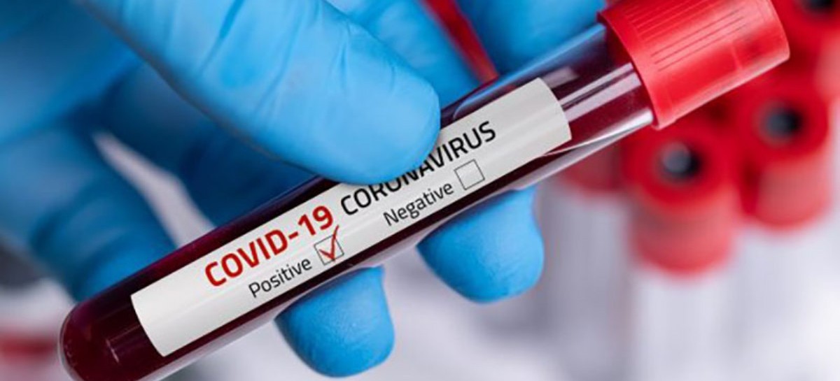 Coronavirus: el Gobierno nacional confirmó 214 muertes y 8.159 nuevos contagios en las últimas 24 hs
