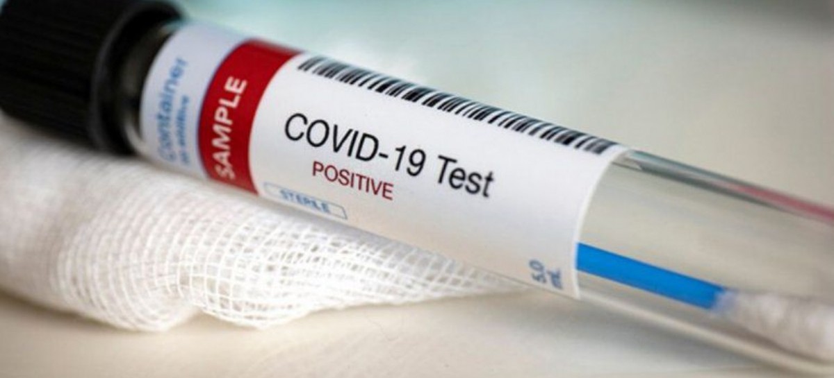 Coronavirus: el Gobierno nacional confirmó 406 muertes y 13477 nuevos contagios en las últimas 24 hs