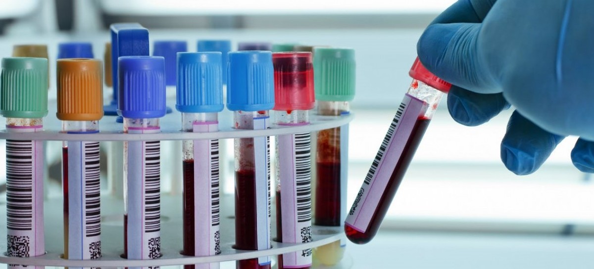 Coronavirus: el Gobierno nacional confirmó 241 muertes y 11507 nuevos contagios en las últimas 24 hs