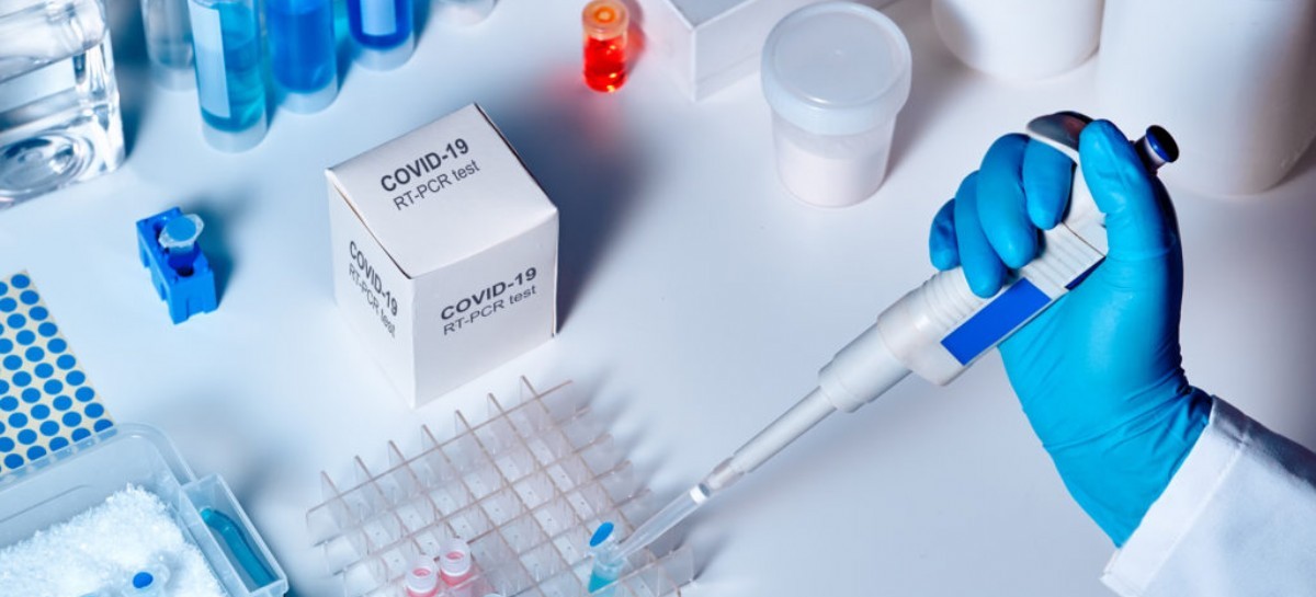 Coronavirus: el Gobierno nacional confirmó 104 muertes y 7.187 nuevos contagios en las últimas 24 hs