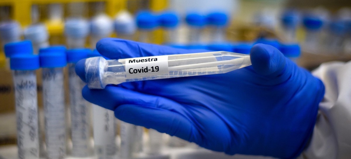 Coronavirus: el Gobierno nacional confirmó 382 muertes y 8.713 nuevos contagios en las últimas 24 hs
