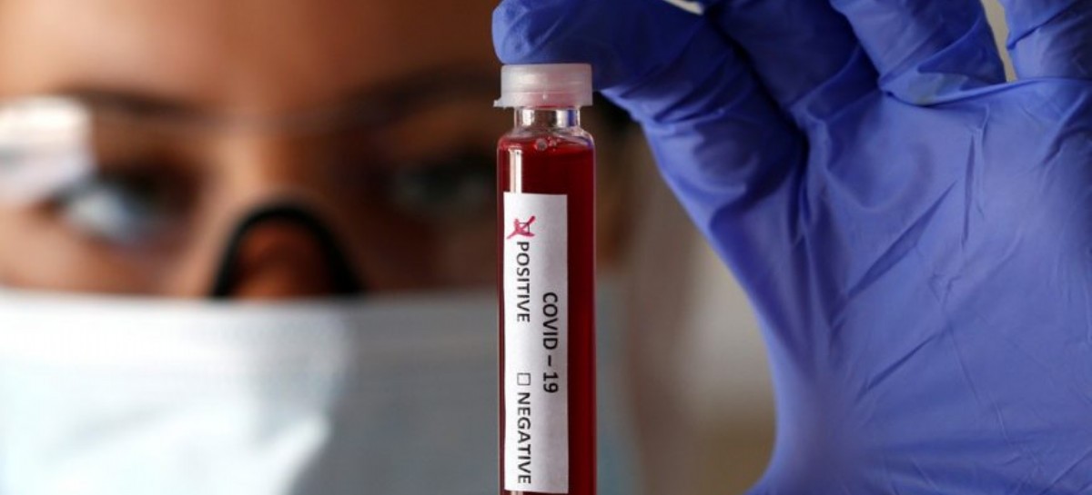 Coronavirus: el Gobierno nacional confirmó 110 muertes y 6.663 nuevos contagios en las últimas 24 hs