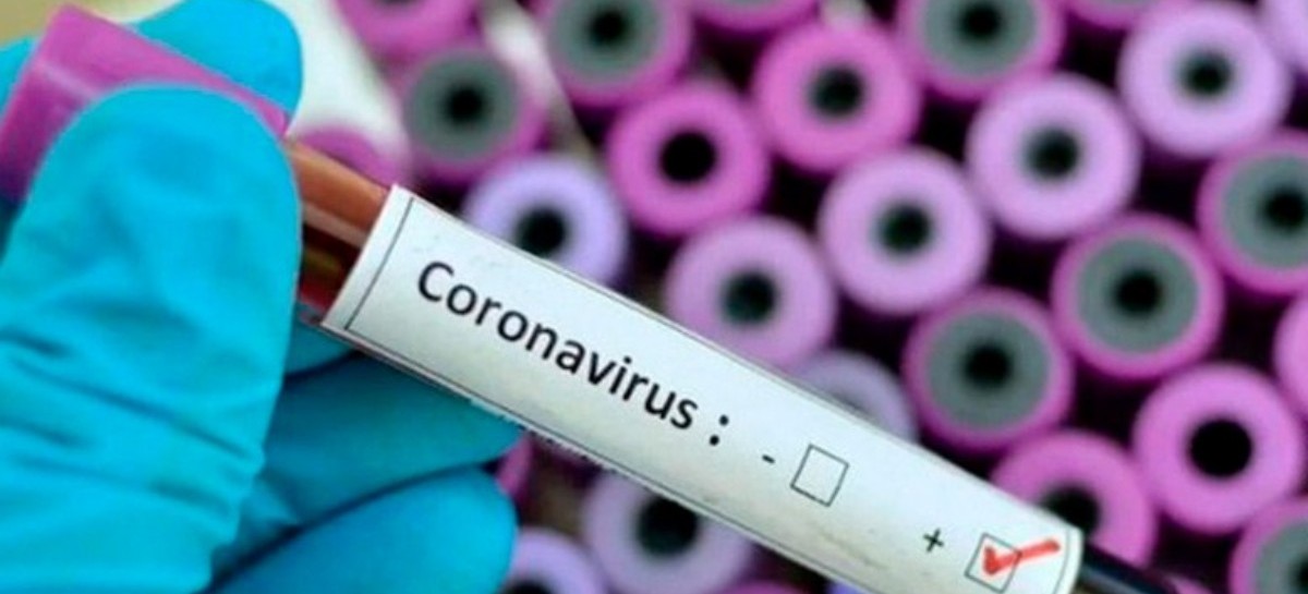 Coronavirus: el Gobierno nacional confirmó 86 muertes y 4.814 nuevos contagios en las últimas 24 hs