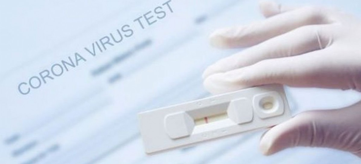 Ante el aumento de contagios e hisopados, la ANMAT autorizó el uso de cuatro autotest de Coronavirus
