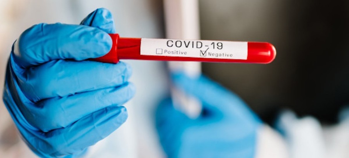 Coronavirus: el Gobierno nacional confirmó 160 muertes y 7.482 nuevos contagios en las últimas 24 hs