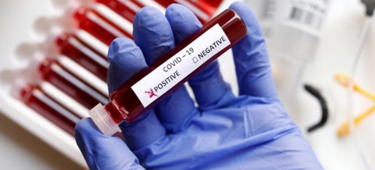 19-10-2020 // Coronavirus: el Gobierno nacional confirmó que se superó el millón de contagios