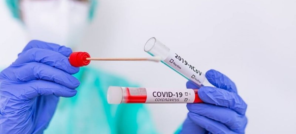 Coronavirus: el Gobierno nacional confirmó 199 muertes y 10933 nuevos contagios en las últimas 24 hs