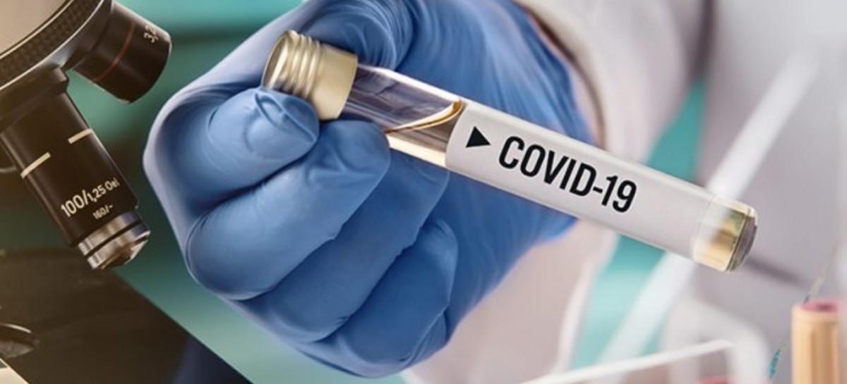Coronavirus: el Gobierno nacional confirmó 89 muertes y 9.056 nuevos contagios en las últimas 24 hs
