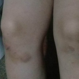 Dos hermanas escaparon del horror: otra vez, el Hogar Rosa Ciampa fue el escenario de la violencia