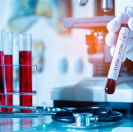Coronavirus: el Gobierno nacional confirmó 485 muertes y 15.454 nuevos contagios