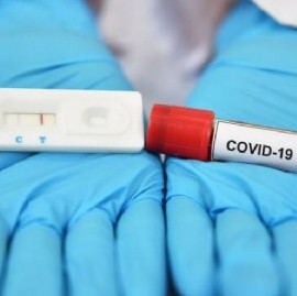 Coronavirus: el Gobierno nacional confirmó 206 muertes y 8.841 nuevos contagios en las últimas 24 hs