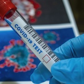Coronavirus: el Gobierno nacional confirmó 197 muertes y 11.129 nuevos contagios