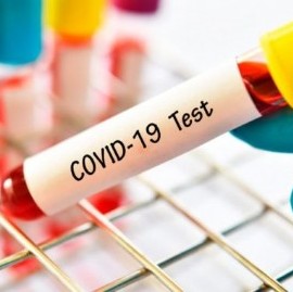 Coronavirus: el Gobierno nacional confirmó 245 muertes y 12026 nuevos contagios en las últimas 24 hs
