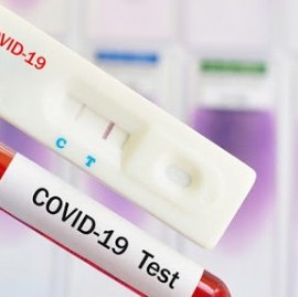Coronavirus: el Gobierno nacional confirmó 223 muertes y 7.668 nuevos contagios