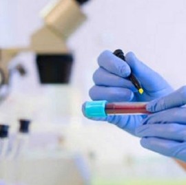 Coronavirus: el Gobierno nacional confirmó 470 muertes y 12027 nuevos contagios en las últimas 24 hs