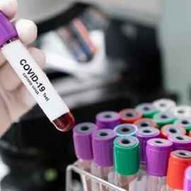 Coronavirus: el Gobierno nacional confirmó 250 muertes y 11905 nuevos contagios en las últimas 24 hs