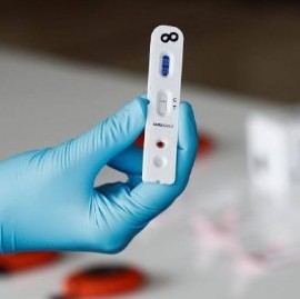 04-11-2020 // Coronavirus: el Gobierno nacional confirmó 469 muertes y 10.652 nuevos contagios