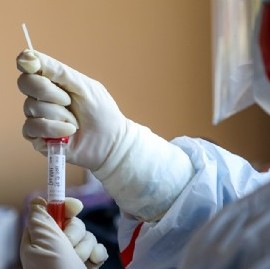 Coronavirus: el Gobierno nacional confirmó 211 muertes y 10104 nuevos contagios en las últimas 24 hs