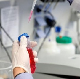 Coronavirus: el Gobierno nacional confirmó 111 muertes y 4.557 nuevos contagios en las últimas 24 hs