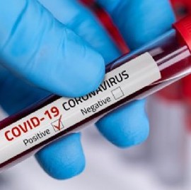 Coronavirus: el Gobierno nacional confirmó 214 muertes y 8.159 nuevos contagios en las últimas 24 hs