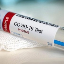 Coronavirus: el Gobierno nacional confirmó 406 muertes y 13477 nuevos contagios en las últimas 24 hs