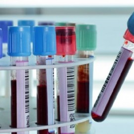 Coronavirus: el Gobierno nacional confirmó 241 muertes y 11507 nuevos contagios en las últimas 24 hs