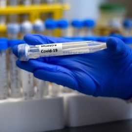Coronavirus: el Gobierno nacional confirmó 382 muertes y 8.713 nuevos contagios en las últimas 24 hs