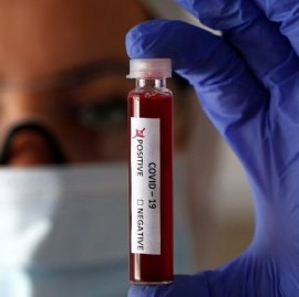 Coronavirus: el Gobierno nacional confirmó 110 muertes y 6.663 nuevos contagios en las últimas 24 hs