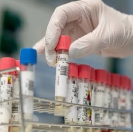18-10-2020 // Coronavirus: el Gobierno nacional confirmó 161 muertes y 10.561 nuevos contagios