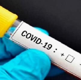 Coronavirus: el Gobierno nacional confirmó 149 muertes y 7.948 nuevos contagios en las últimas 24 hs